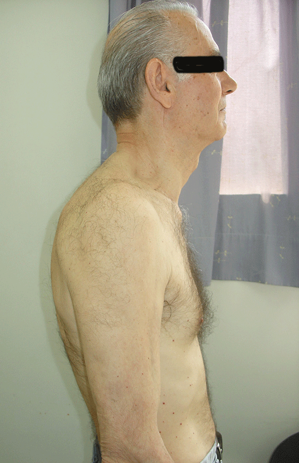 http://www.e-rheumatology.gr/ckfinder/userfiles/images/DISH-Lumpar-Spine-1.gif