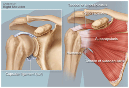 http://img.webmd.com/dtmcms/live/webmd/consumer_assets/site_images/articles/image_article_collections/anatomy_pages/rotator-cuff.jpg